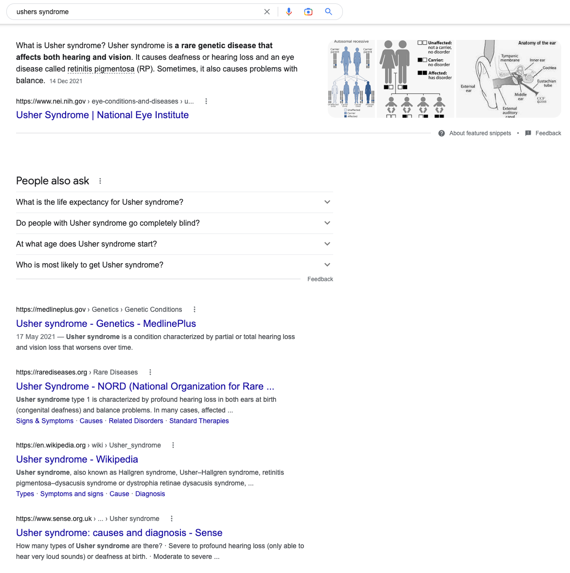 usher syndrome search results with US listings above Scope